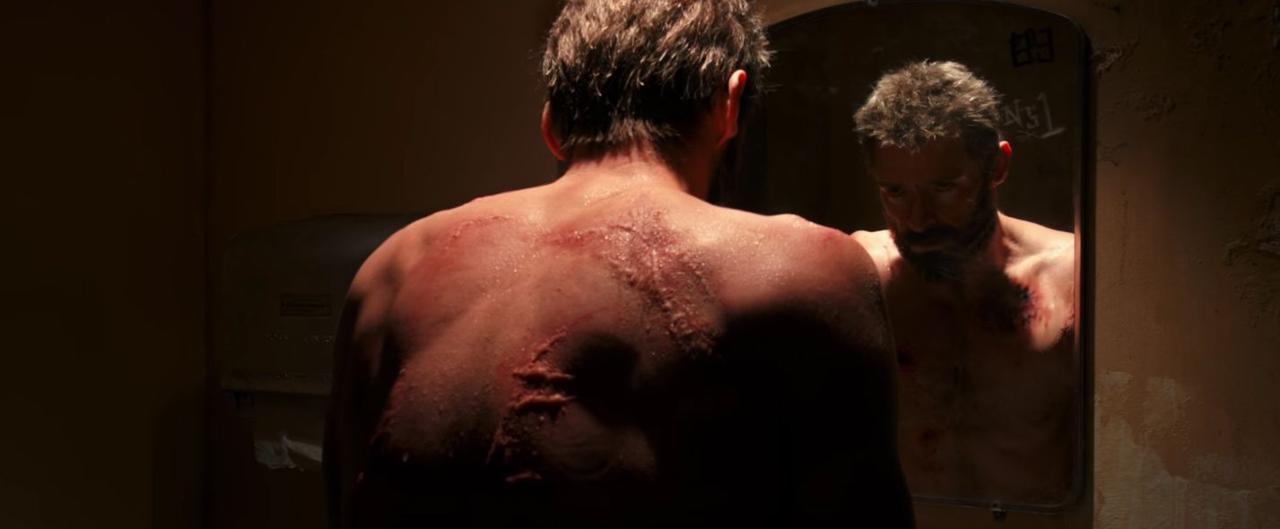 Logan with scars